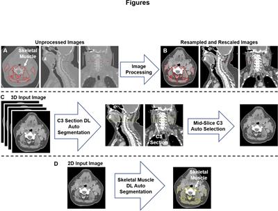 Deep learning auto-segmentation of cervical skeletal muscle for sarcopenia analysis in patients with head and neck cancer